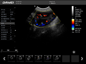 S8筆記本式獸用彩超機-寵物b超機掃描圖