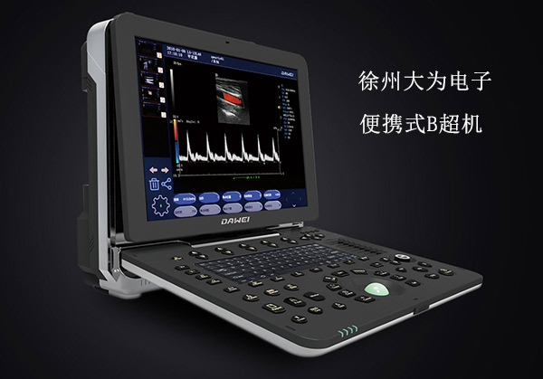 腹部B超機與陰道B超機區別 便攜式B超機圖