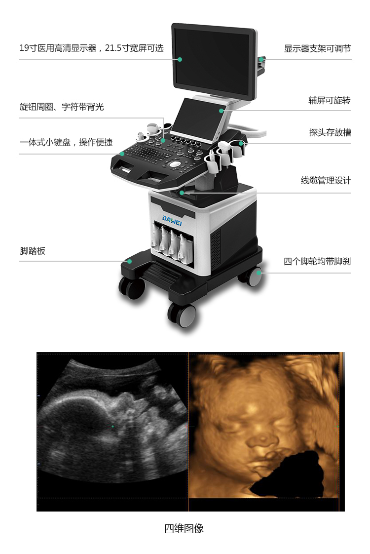 四維彩超配置臨床圖形