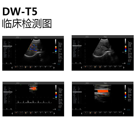 彩超機臨床檢測圖